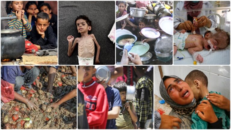 Gazze’de Açlık